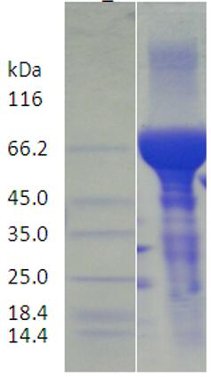 15% SDS-PAGE analysis profiles of purified AB57_3396-23-691 (CBB stained).